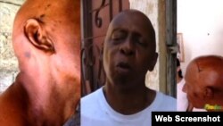 Guillermo Fariñas muestras los maltratos físicos durante el arresto domingo 20 